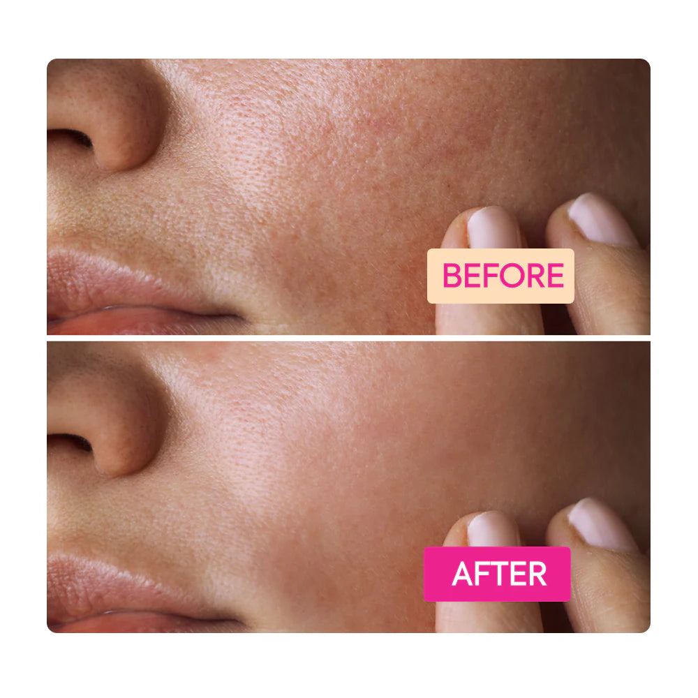 NIACINAMIDE FACIAL CLEANSING BAR