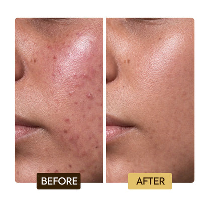 SKIN REPAIRING & CLARIFYING SERUM NEW PACKAGE