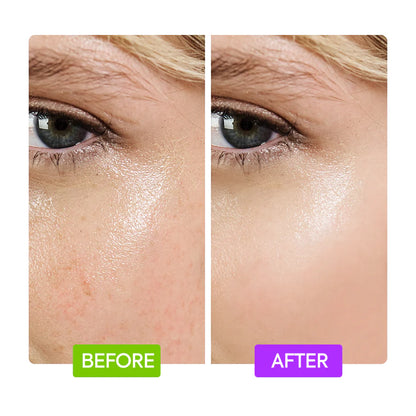 20% AHA+10% NIANCINIMIDE BOOSTER