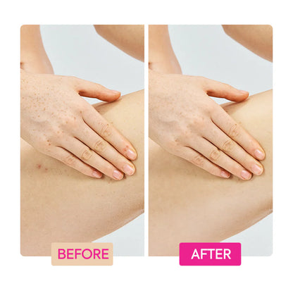 GINGER EXTRACT + TRANEXAMIC ACID + RETINOL BODY TONING CREAM