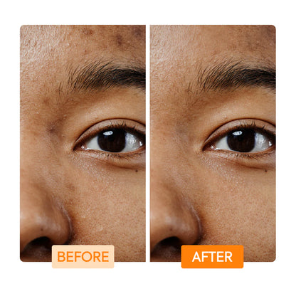 VITAMIN C & TURMERIC FACIAL CLEANING BAR