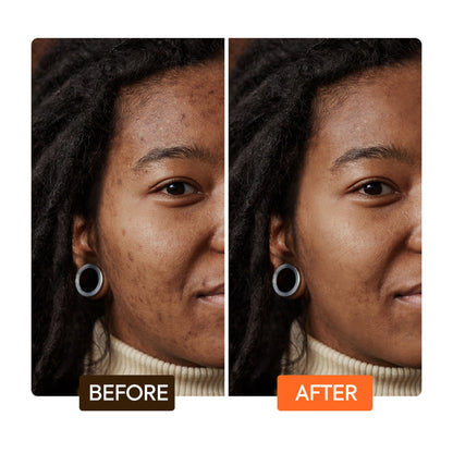 Extreme Argan Exfoliating Soap with Apricot Seed Extract