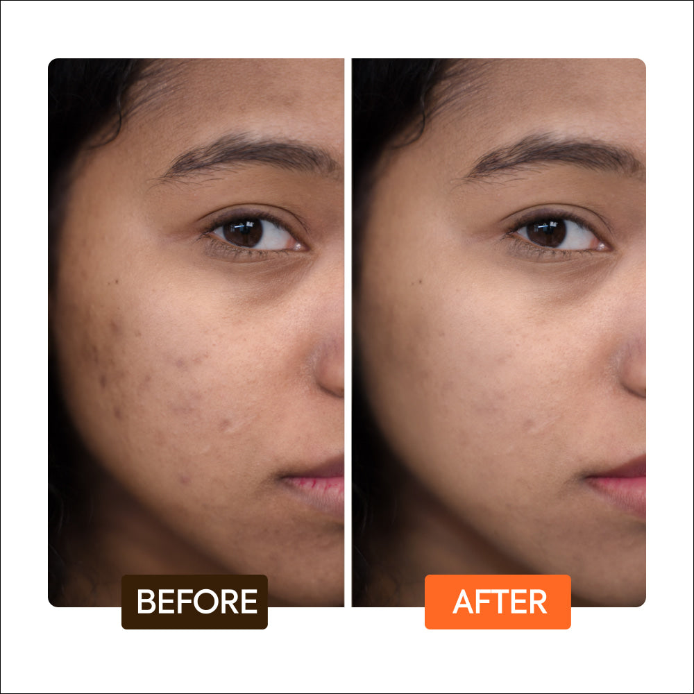 Tone Boosting Cream for Maturing Skin Types