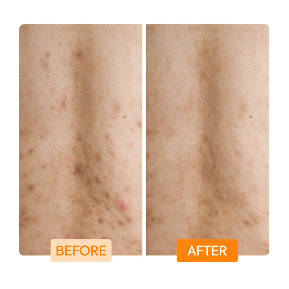 Gently exfoliate with lactic acid niacinamide body wash
