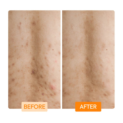 Gently exfoliate with lactic acid niacinamide body wash