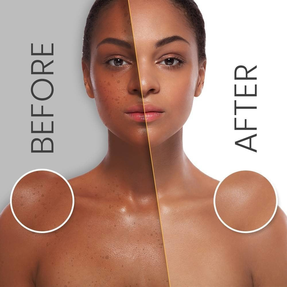 Makari Multi-action Extreme Toning Face Cream Spf 15